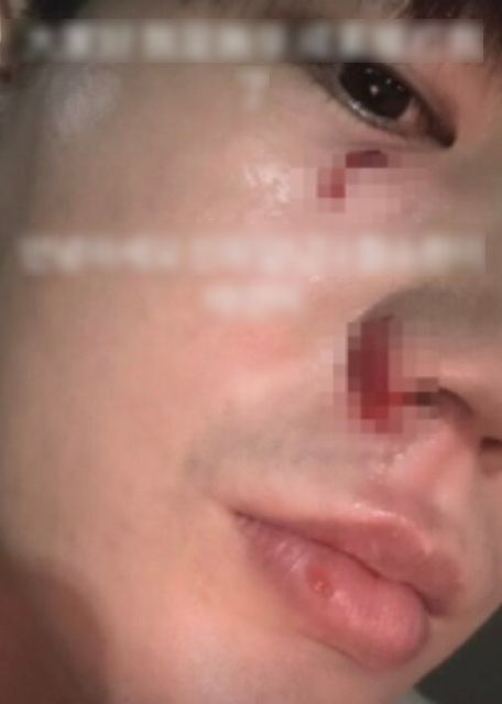 Hoa hậu bị tố đ&aacute;nh chồng- Ảnh 1.