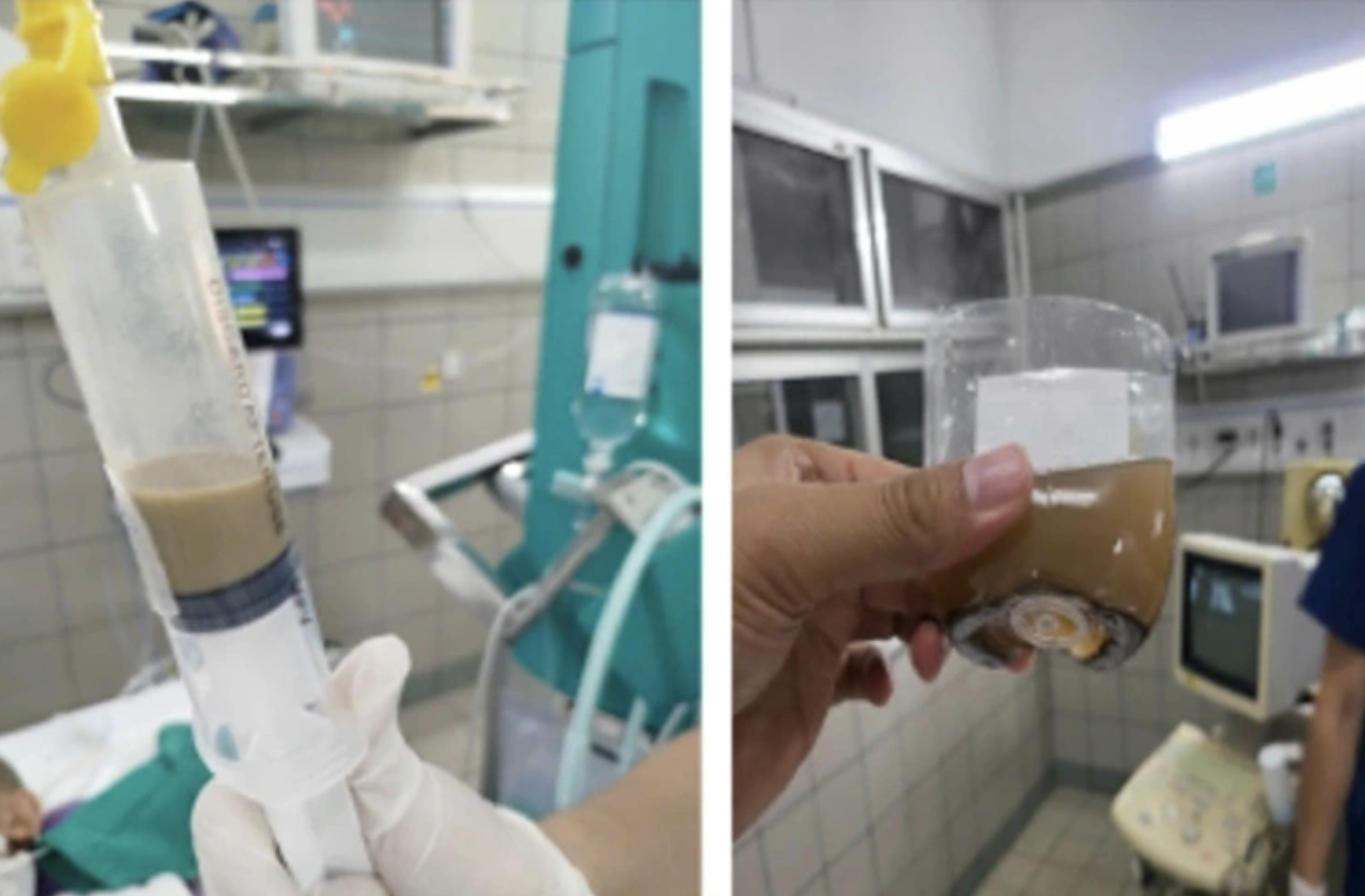 Hội chẩn với chuyên gia Nhật cứu cháu bé vụ lũ quét- Ảnh 2.