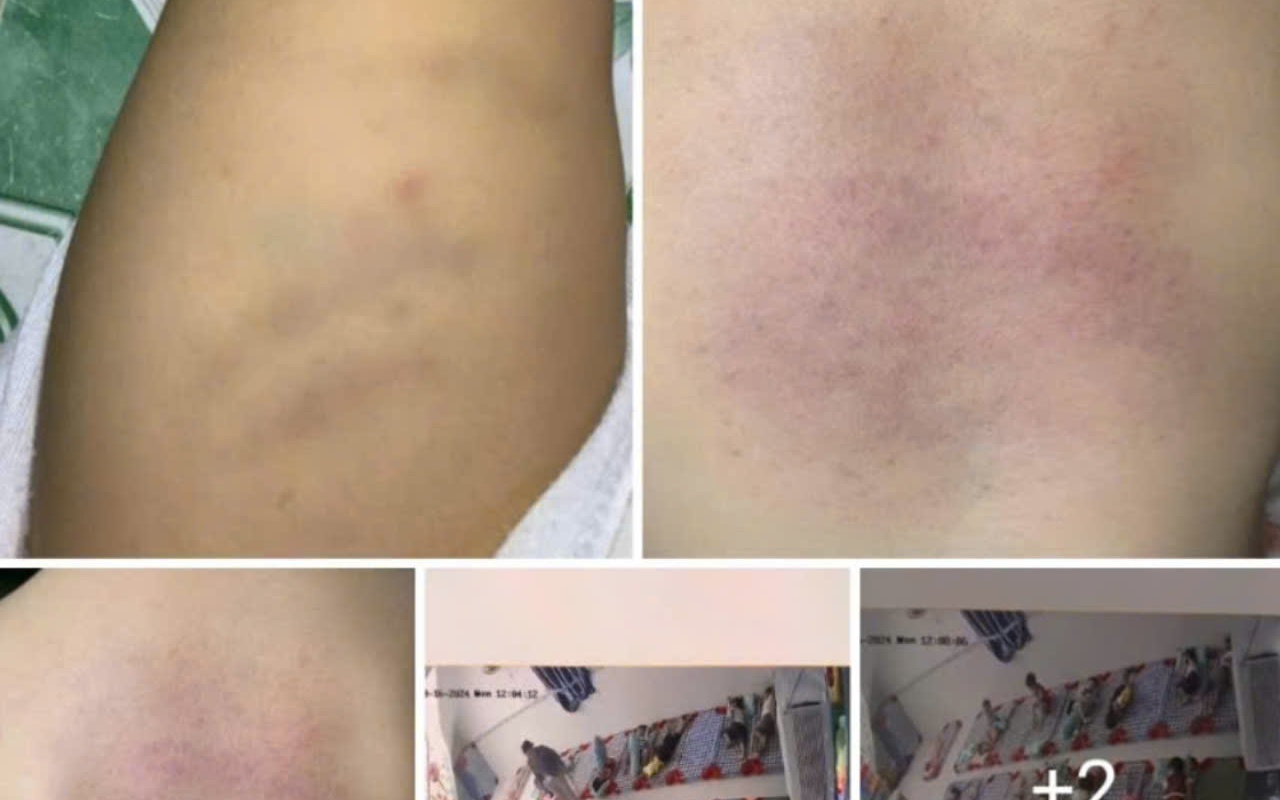 Vụ cháu bé bị bạo hành ở Bình Thuận: Chủ nhóm trẻ xin lỗi, mong được tha thứ