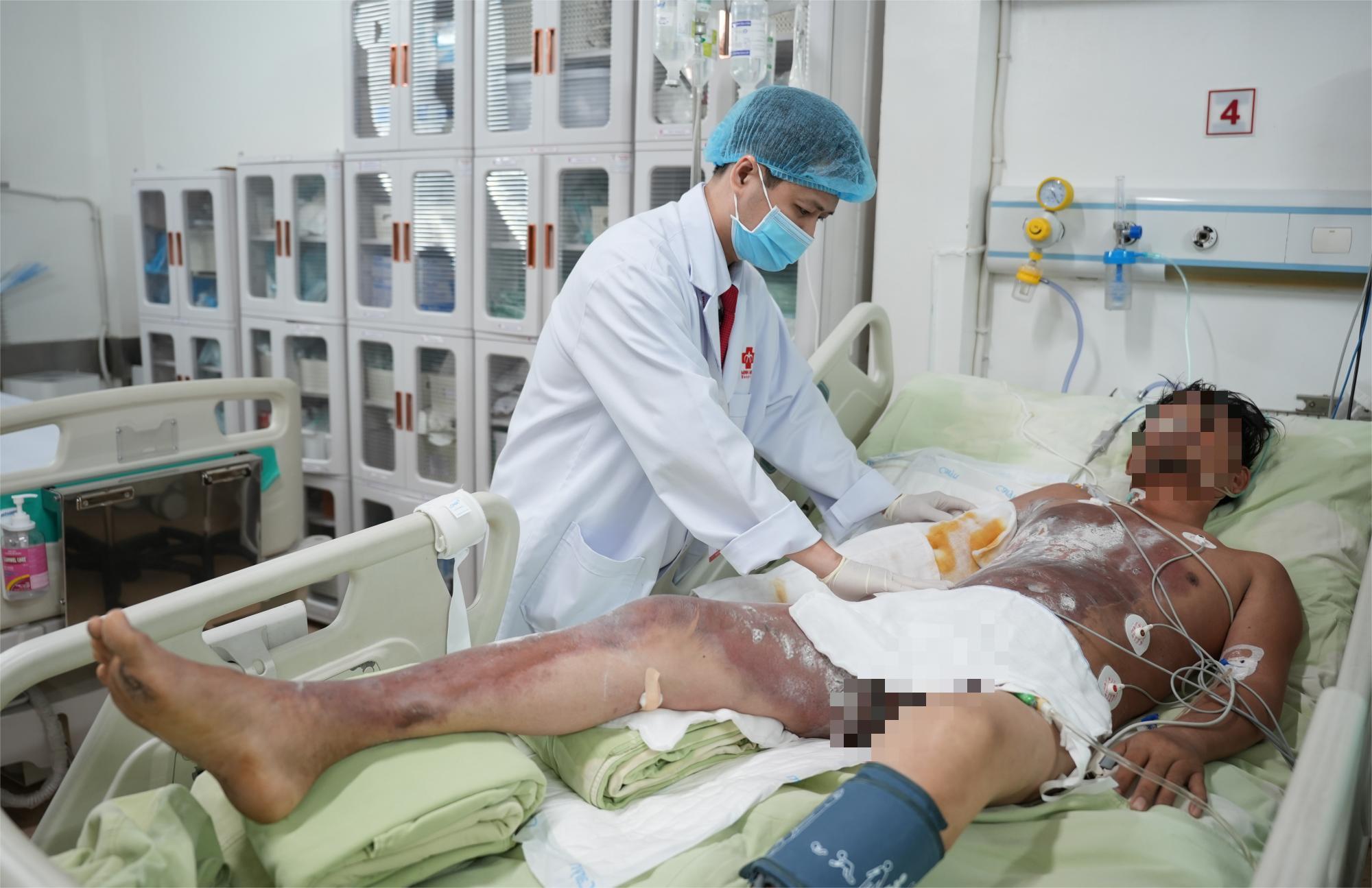 Cứu sống người đ&agrave;n &ocirc;ng Campuchia bỏng điện cao thế thương t&acirc;m - Ảnh 1.
