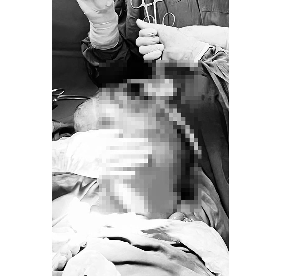 Thấy bụng to bất thường, người phụ đi kh&aacute;m th&igrave; ph&aacute;t hiện điều bất ngờ - Ảnh 1.