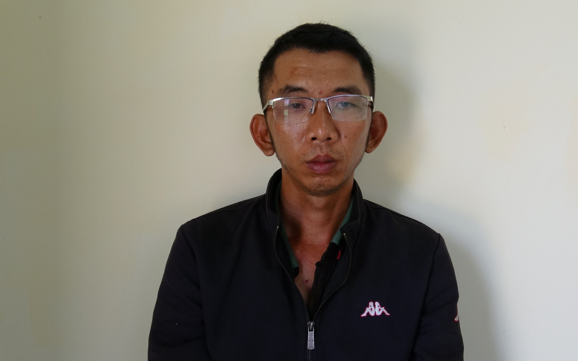 Thanh niên bị chém lìa bàn tay vì tưởng phòng trọ vẫn còn là điểm massage