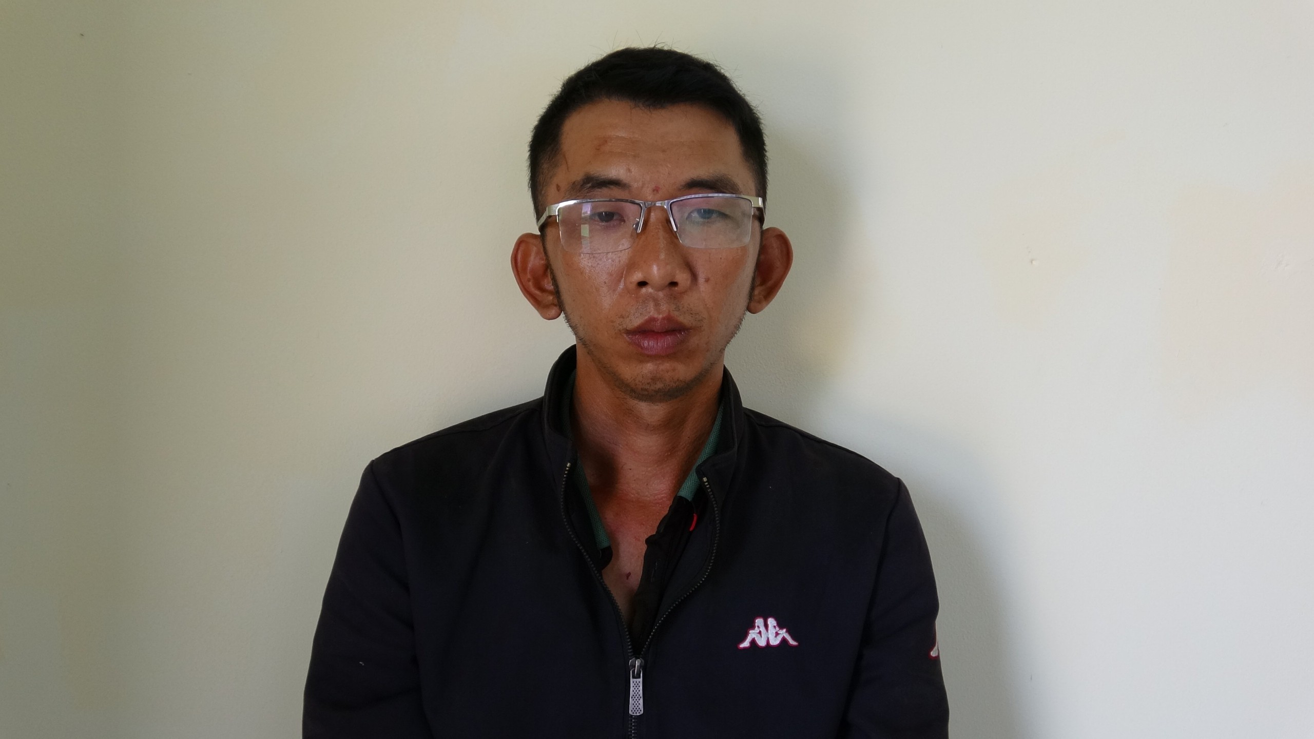 Trần Văn Hiền Em ch&eacute;m người nhầm chỗ massage g&acirc;y thương t&iacute;ch nặng nề - Ảnh 1.