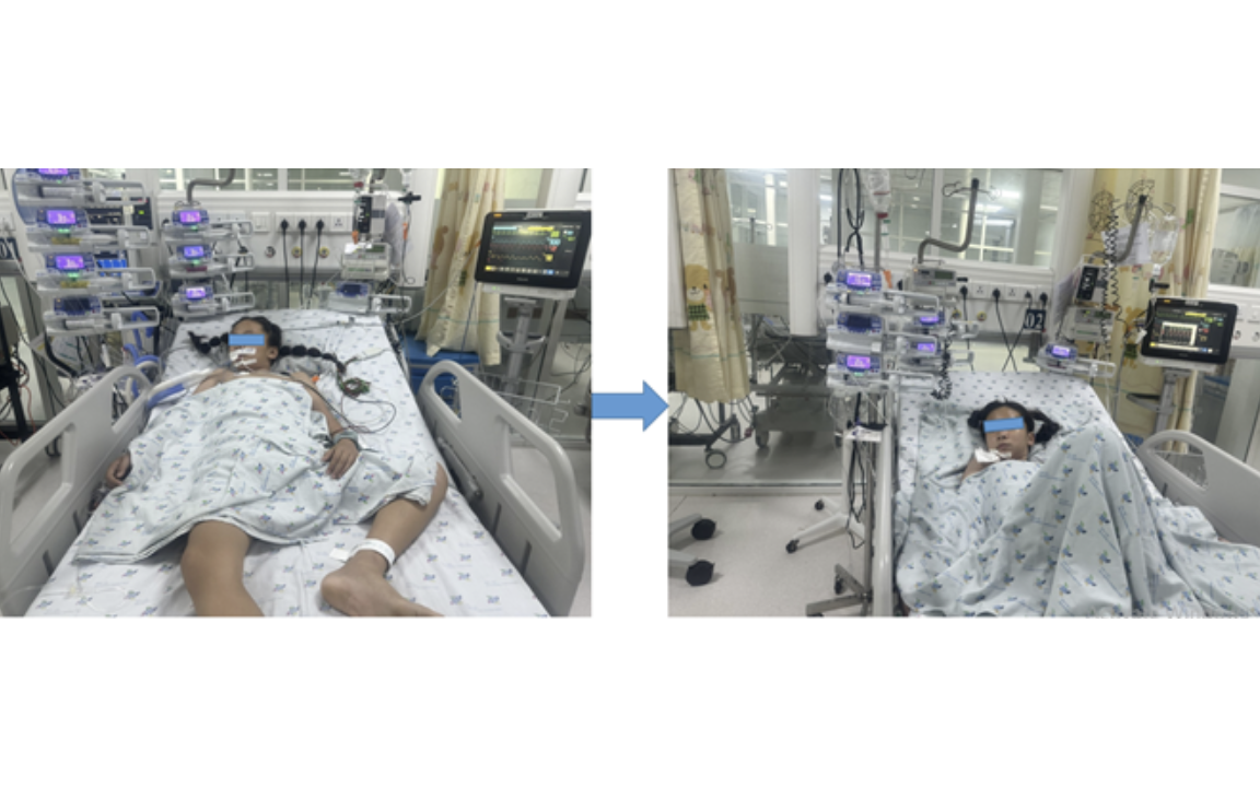 Từ căn bệnh khiến da kh&ocirc; cứng đến tắc ruột hiếm gặp ở c&ocirc; g&aacute;i trẻ - Ảnh 2.