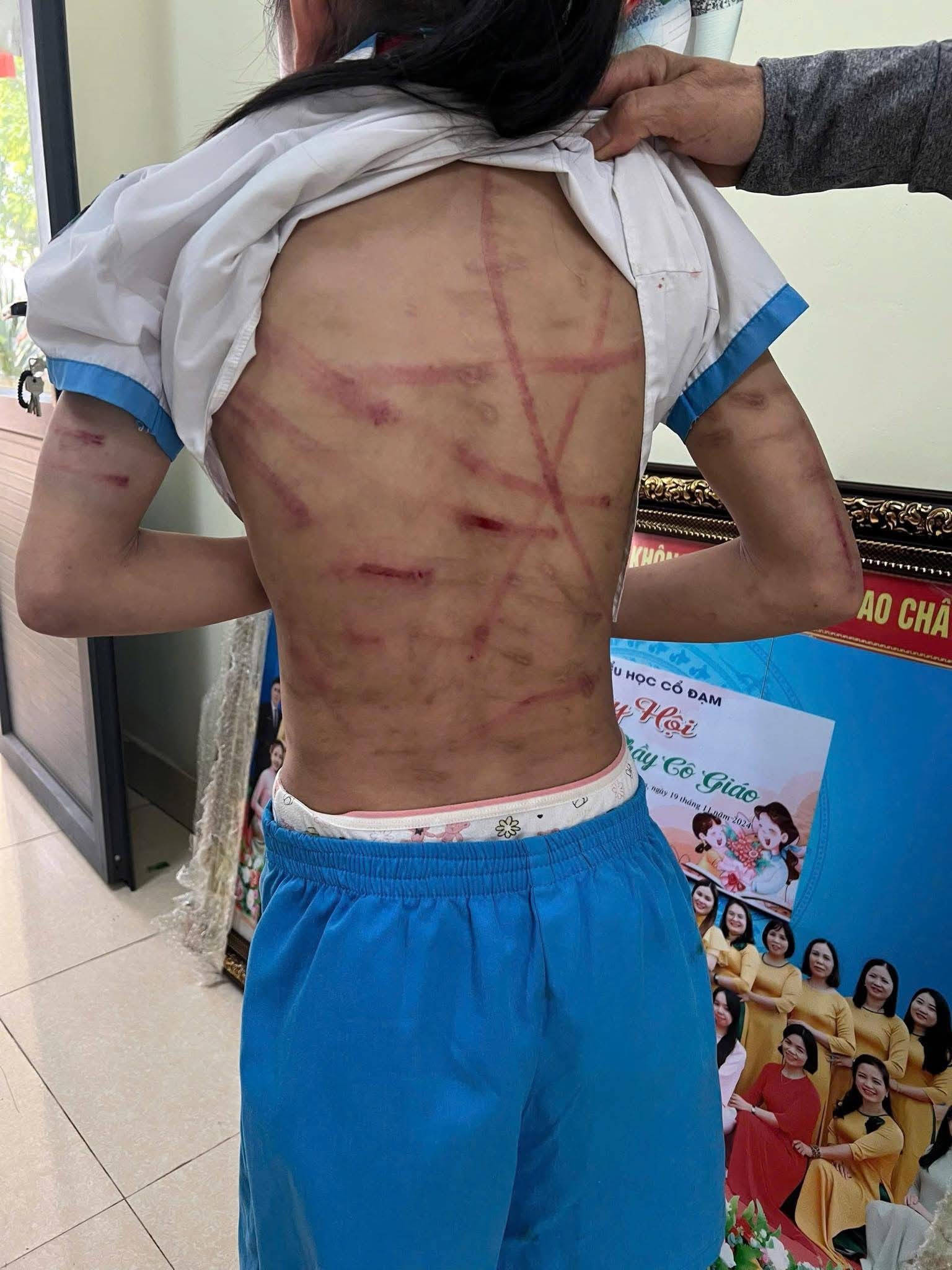 Vụ b&eacute; g&aacute;i lớp 5 ở H&agrave; Tĩnh bị bạo h&agrave;nh: C&ocirc;ng an l&agrave;m việc với cha dượng  - Ảnh 5.