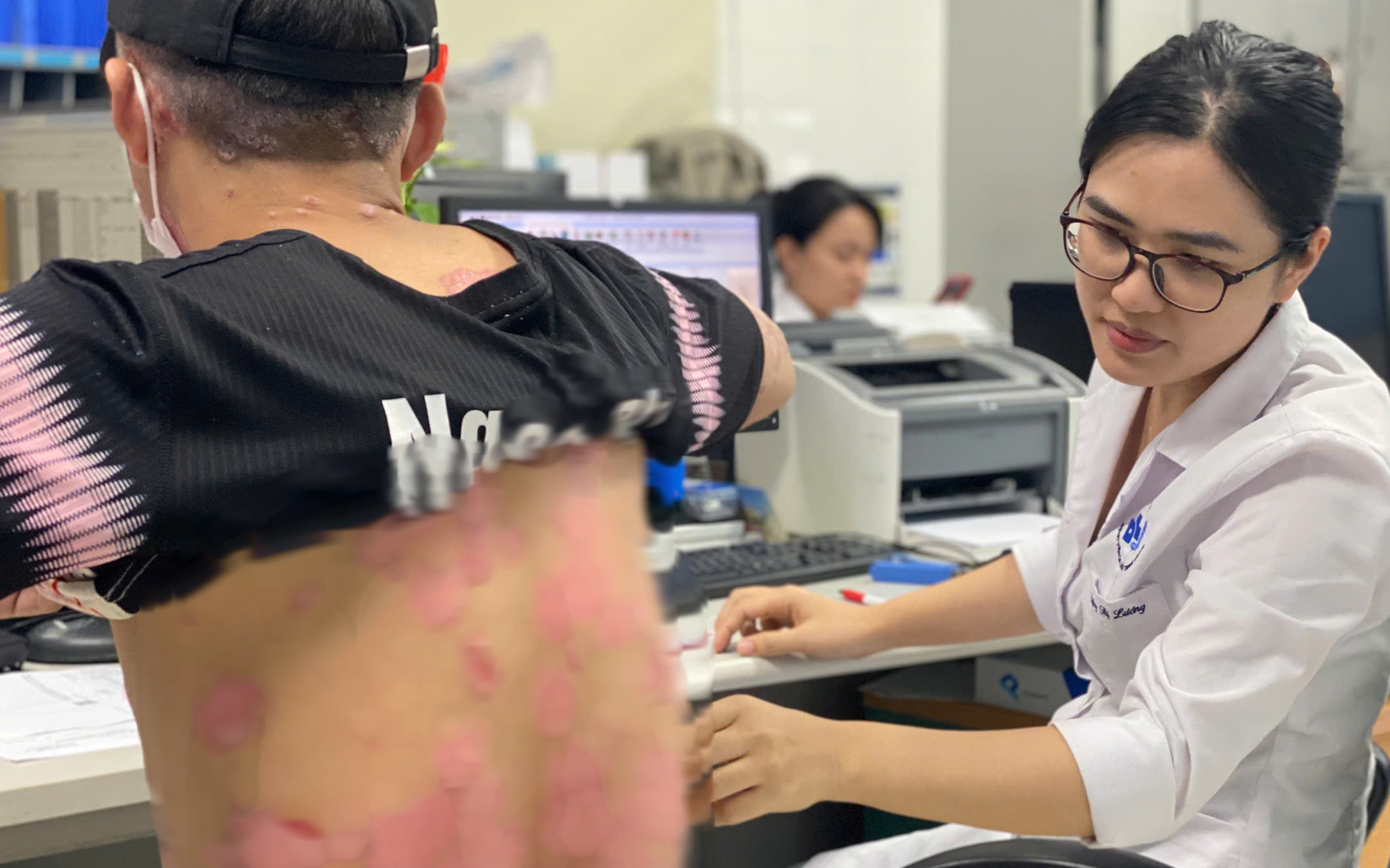 Khám miễn phí bệnh vảy nến