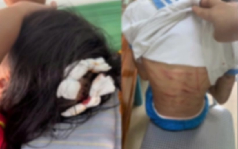 Từ đòn roi trong nhà đến "bạo lực biểu diễn" trên TikTok: Trẻ em đang bị tổn thương ở mọi nơi
