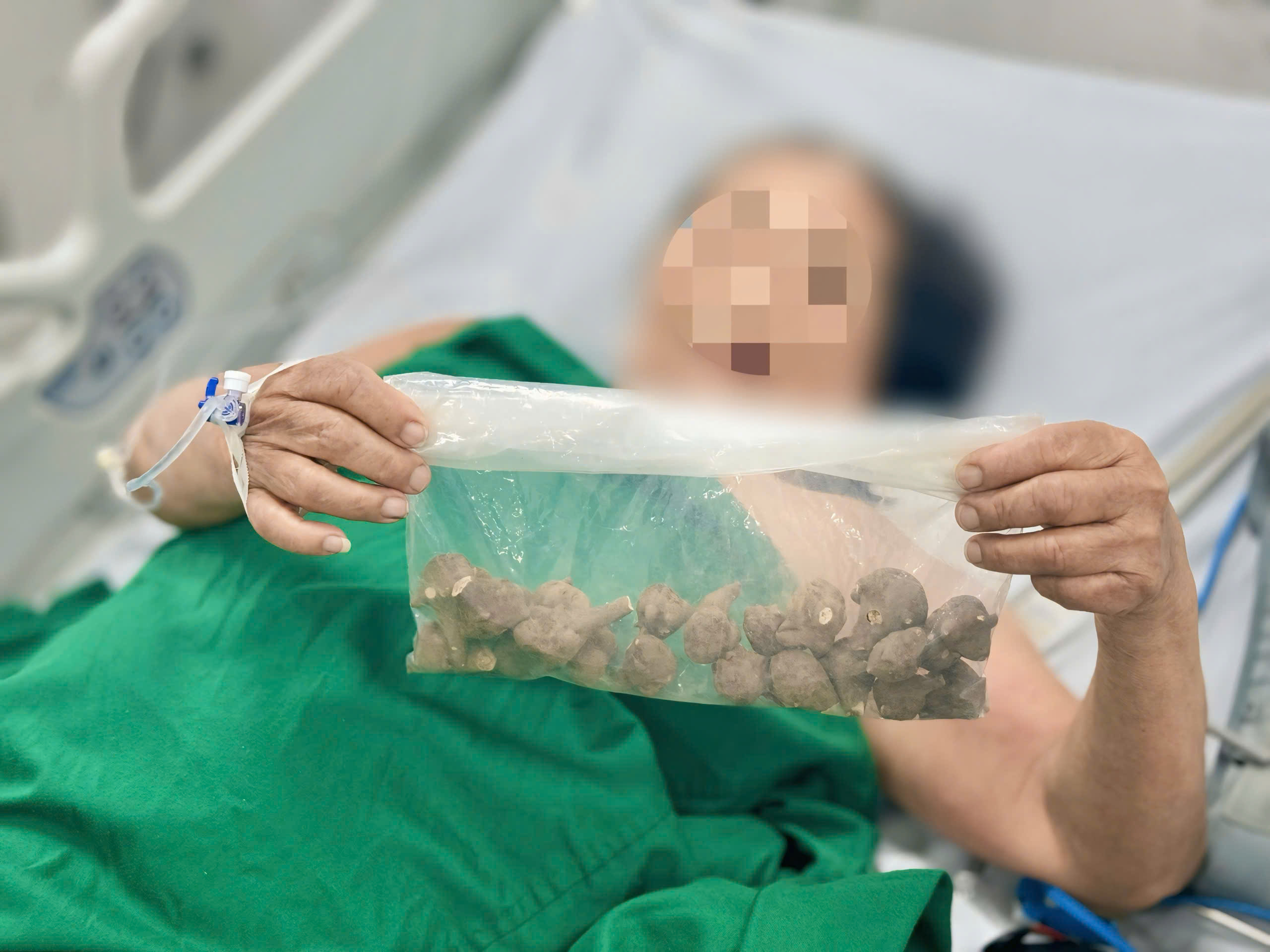 Ăn một loại củ quen thuộc chữa xương khớp, người phụ nữ nguy kịch - Ảnh 2.