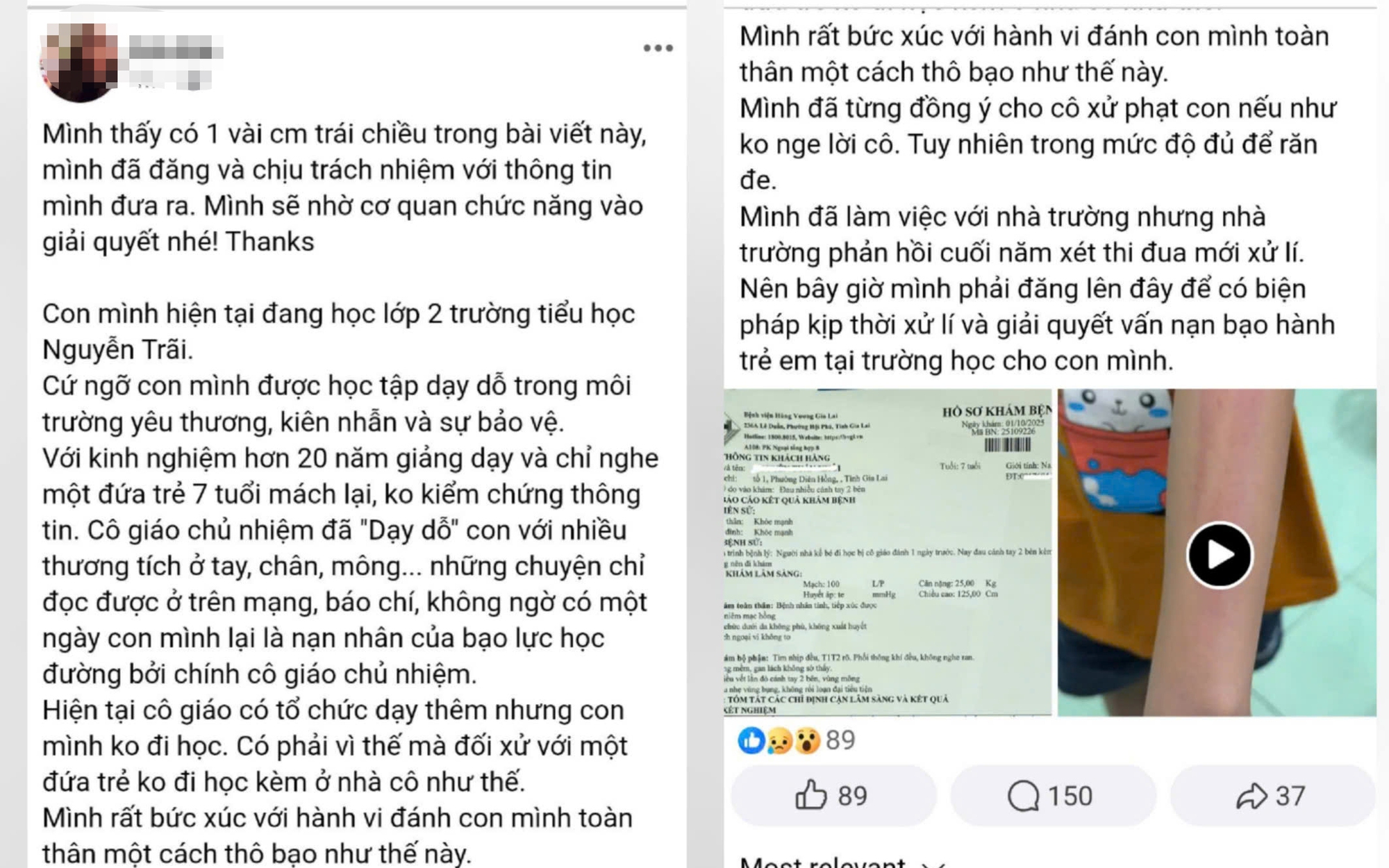 Nh&agrave; trường l&ecirc;n tiếng vụ c&ocirc; gi&aacute;o đ&aacute;nh học sinh lớp 2 g&acirc;y x&ocirc;n xao mạng x&atilde; hội - Ảnh 2.