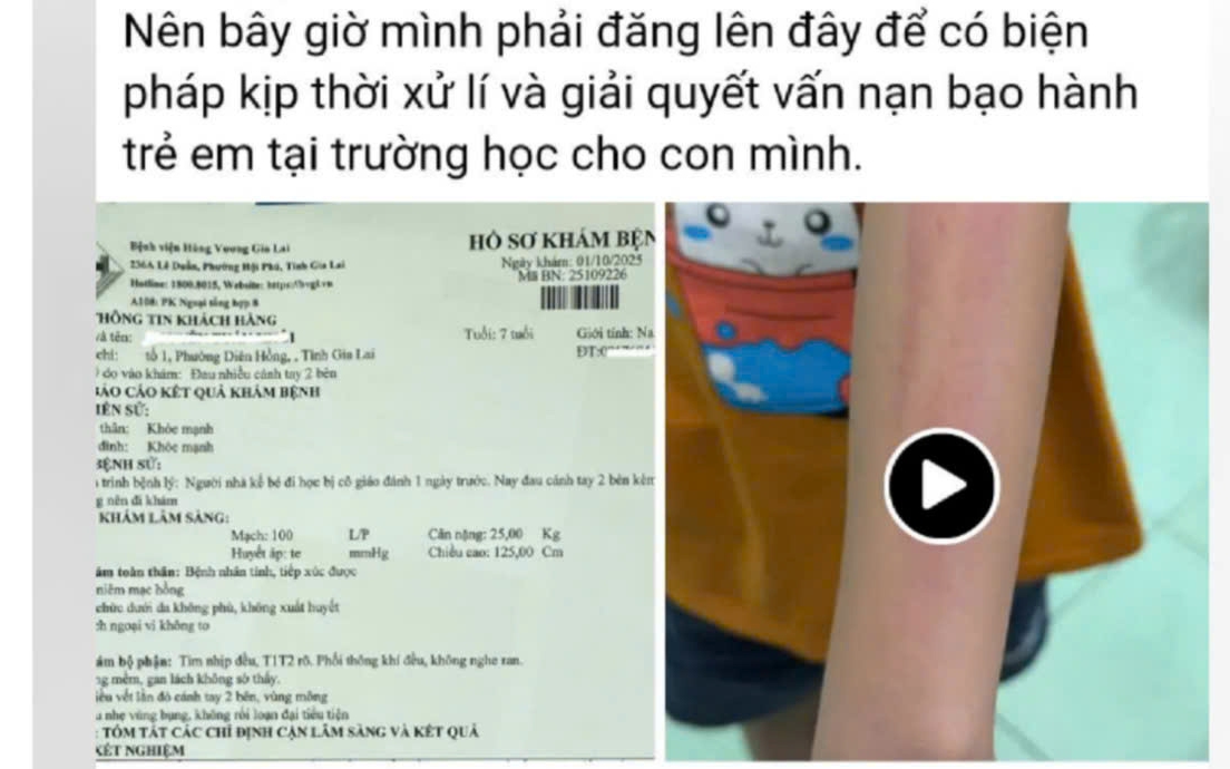Nhà trường lên tiếng vụ cô giáo đánh học sinh lớp 2 gây xôn xao