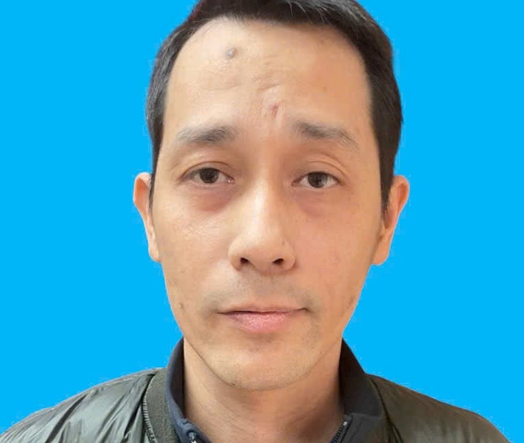 M&acirc;u thuẫn gia đ&igrave;nh nghi&ecirc;m trọng: Em chồng đ&acirc;m chị d&acirc;u trọng thương tại Hải Ph&ograve;ng - Ảnh 1.