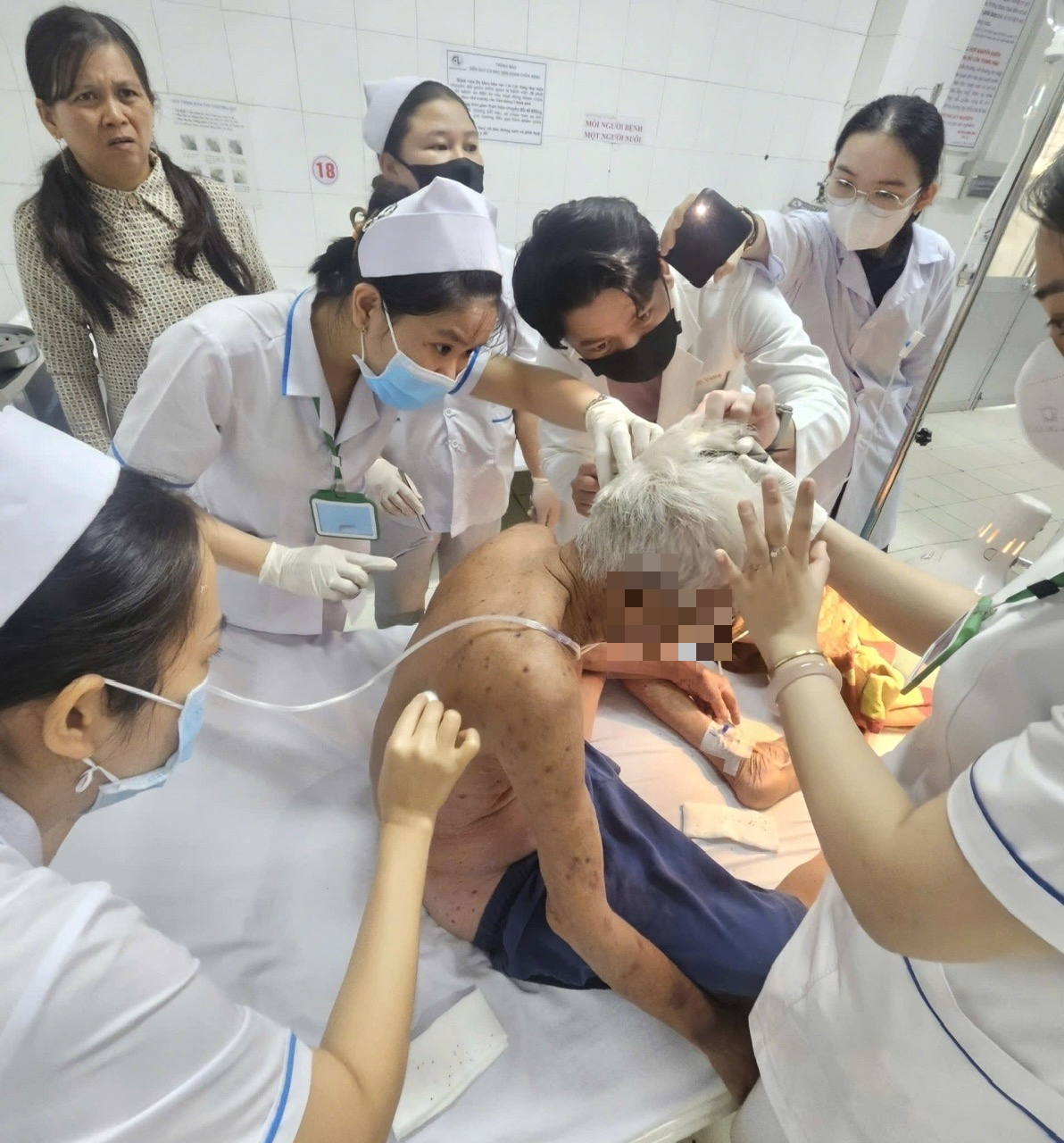 Cụ ông 74 tuổi ở Đồng Tháp bị ong đốt hơn 100 mũi đã tử vong - Ảnh 1.