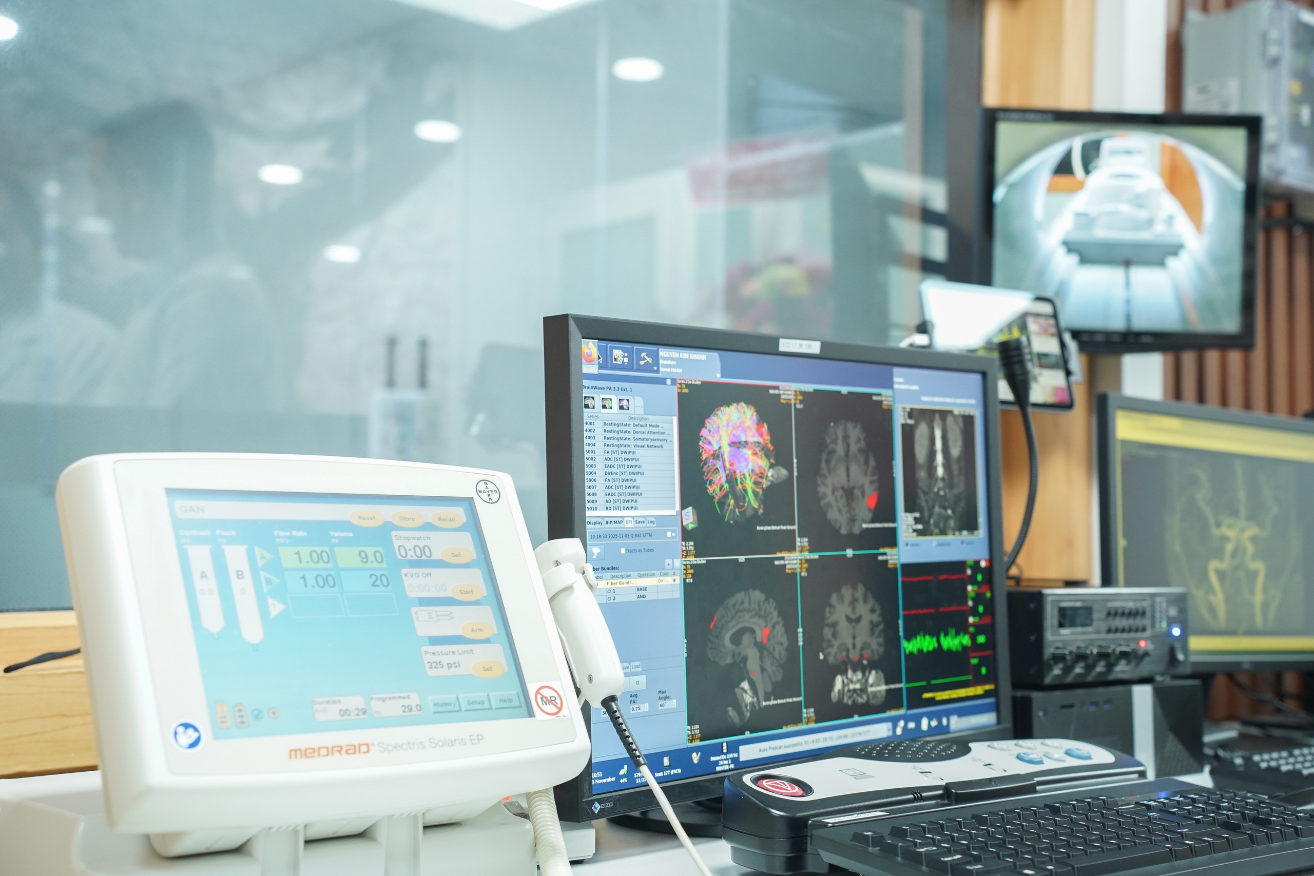 Lần đầu ti&ecirc;n tại Bệnh viện Chợ Rẫy c&oacute; m&aacute;y MRI ph&aacute;t hiện sớm đột quỵ, ung thư - Ảnh 3.