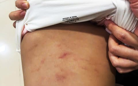Cà Mau: Tạm dừng hoạt động nhóm trẻ nơi bé gái 2 tuổi bị bạo hành