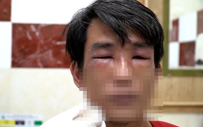 TP HCM vào mùa kiến ba khoang: cảnh báo người dân kiểm tra chăn màn