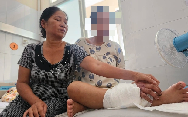 Tin vui với cô gái trẻ mang song thai bị tai nạn lao động phải ghép bàn tay vào chân