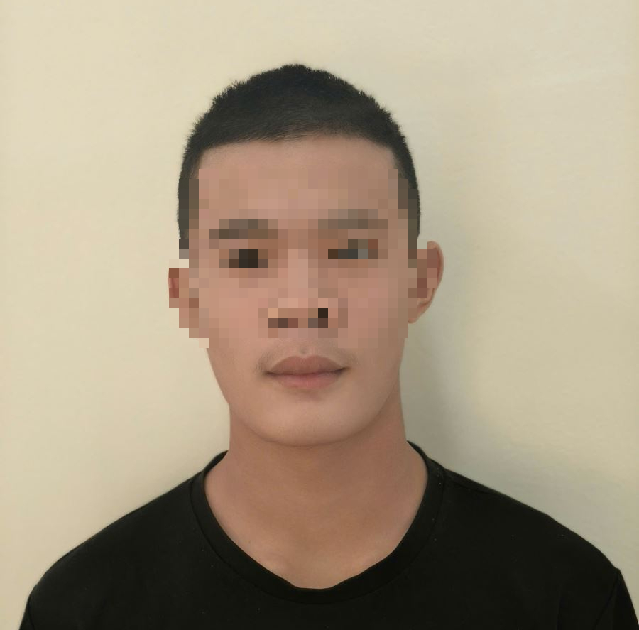 Thanh niên 17 tuổi gây thương tích 60 % cho người khác bằng điếu cày - Ảnh 1.