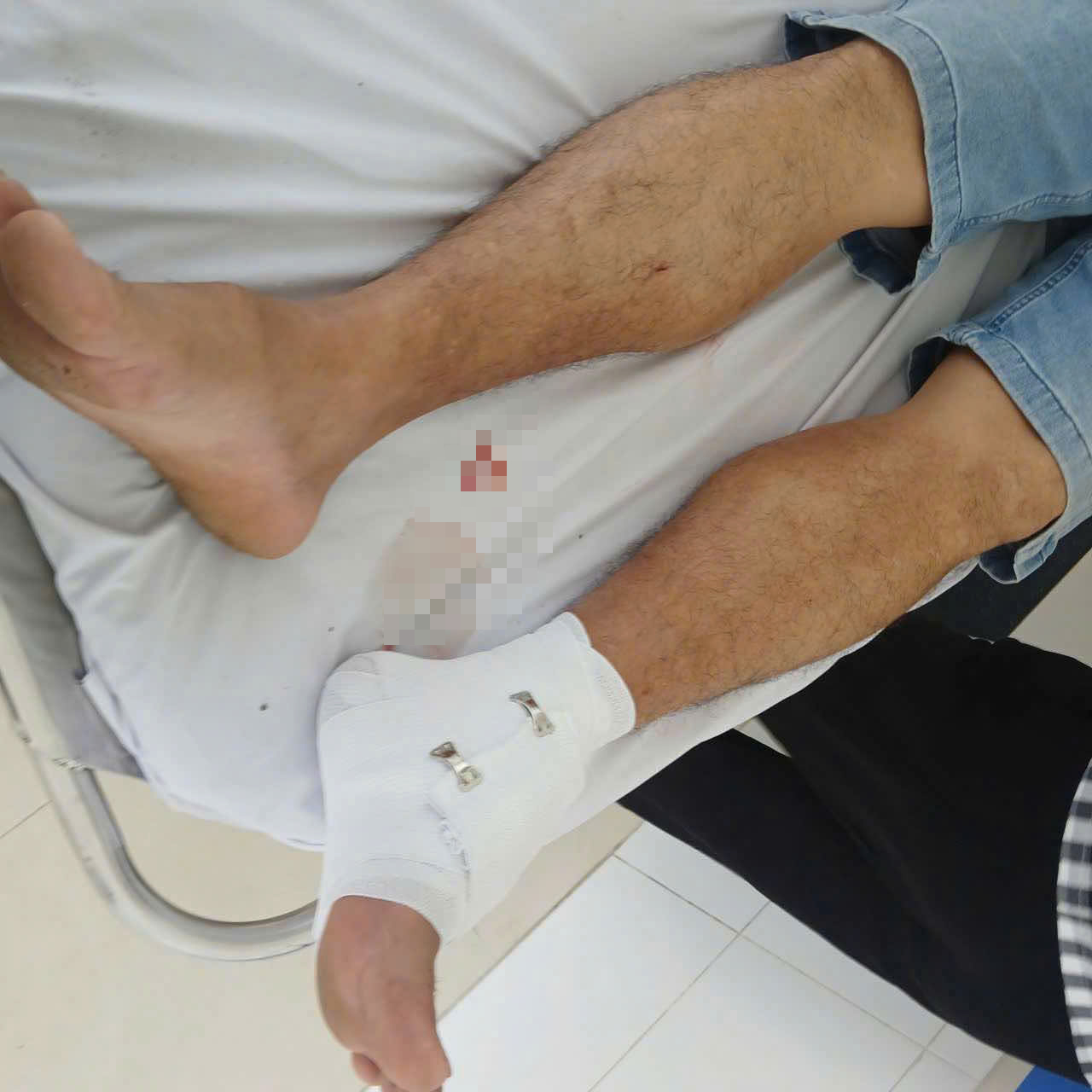 Vụ cá sấu cắn thầy giáo ở Tây Ninh và án Phạt 315 triệu đồng cho người nuôi - Ảnh 2.