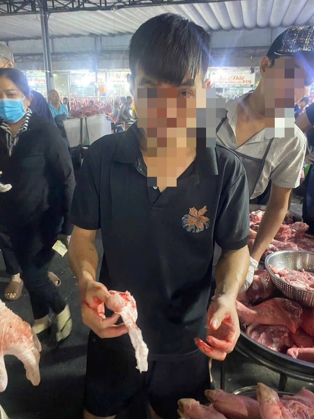 C&ocirc;ng an khẩn trương v&agrave;o cuộc vụ một người bị đ&aacute;nh g&atilde;y mũi ở Chợ đầu mối H&oacute;c M&ocirc;n - Ảnh 1.