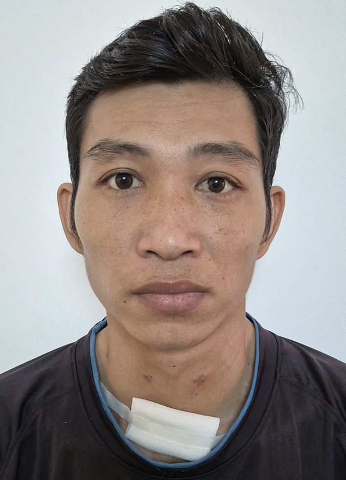 Kẻ sát hại người yêu vì Ghen tuông và tự sát bất thành ở Đồng Nai - Ảnh 1.