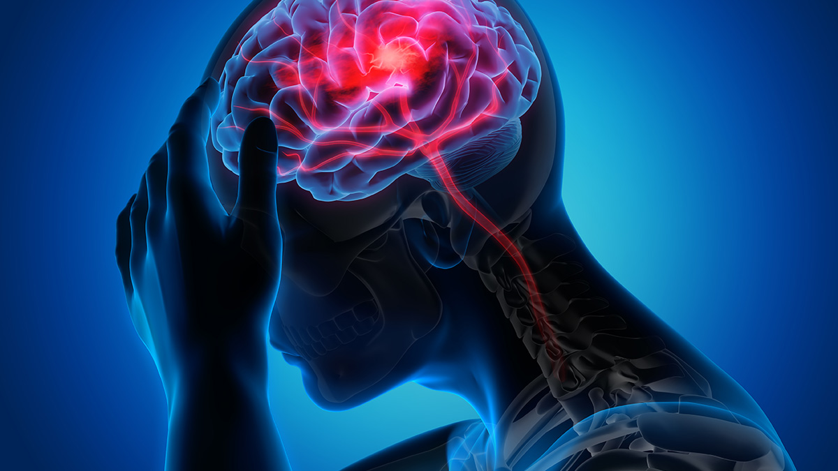 Đột quỵ gia tăng: Nghiên cứu Mỹ hé lộ thủ phạm mới - Ảnh 1.