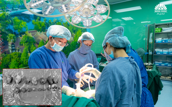 Thai lớn 34 tuần, bác sĩ phát hiện khối u buồng trứng đã hoại tử - Ảnh 2.