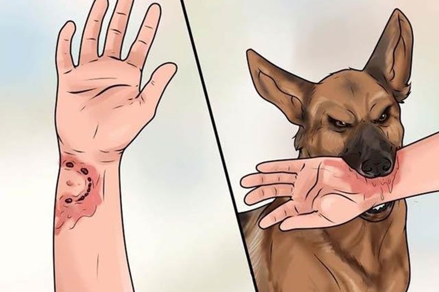 Đồng Nai c&oacute; trường hợp tử vong sau gần 1 năm bị ch&oacute; cắn- Ảnh 1.
