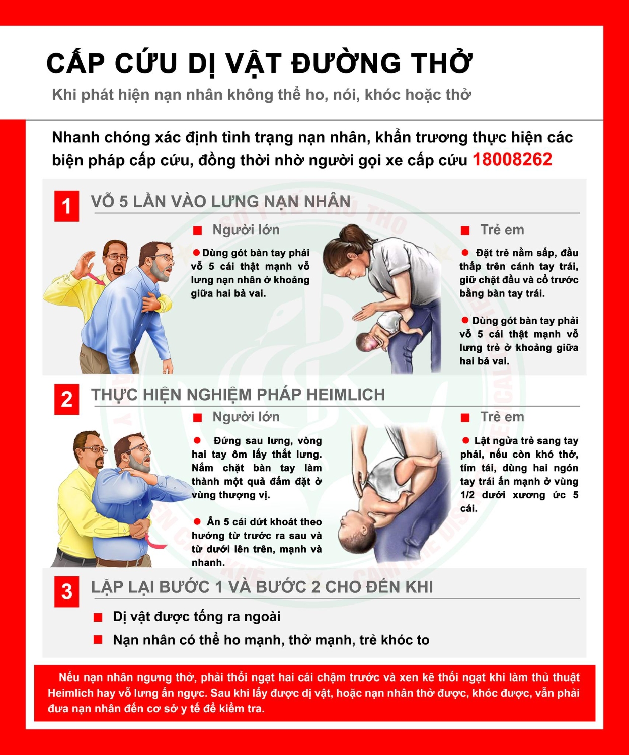 Vỡ dạ dày vì người thân thực hiện ép bụng đẩy dị vật ra sai cách- Ảnh 2.
