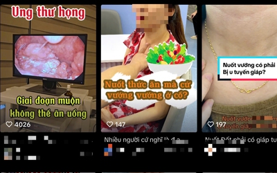 Hoa mắt trước "bác sĩ TikTok"