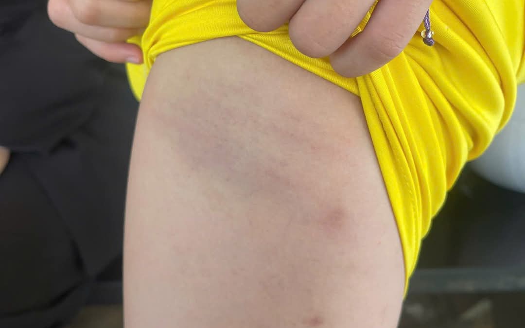 Phạt hành chính, tạm dừng giảng dạy đối với giáo viên dùng dây điện đánh học sinh