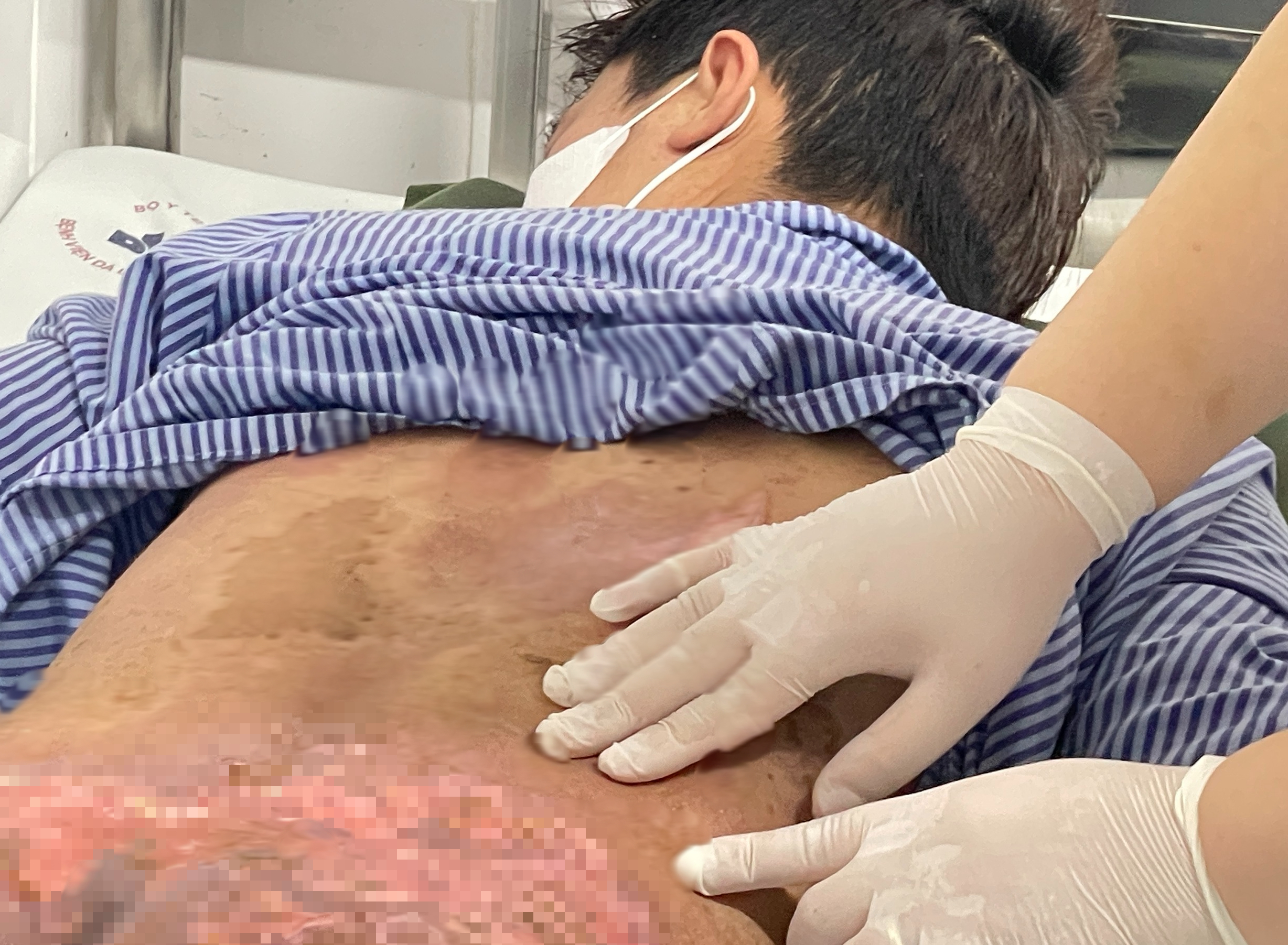 Chữa ngứa bằng hơn 40 con kiến ba khoang, nam thanh niên nhập viện- Ảnh 1.