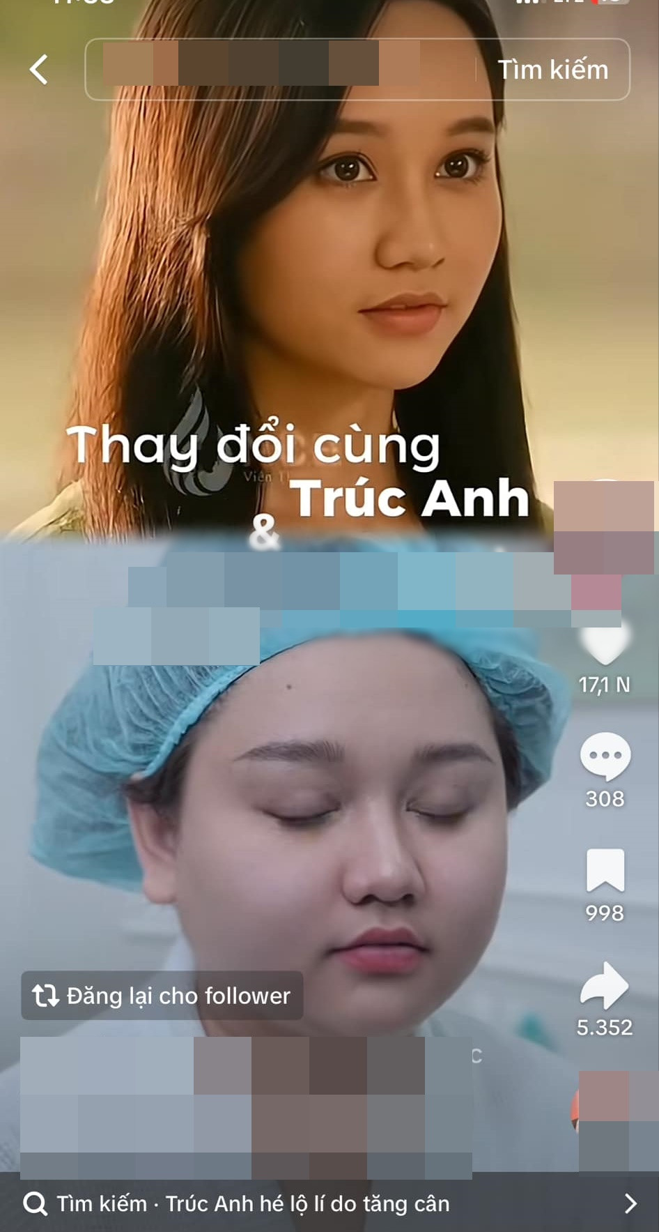 Tr&uacute;c Anh "Mắt biếc" đi thẩm mỹ?- Ảnh 2.