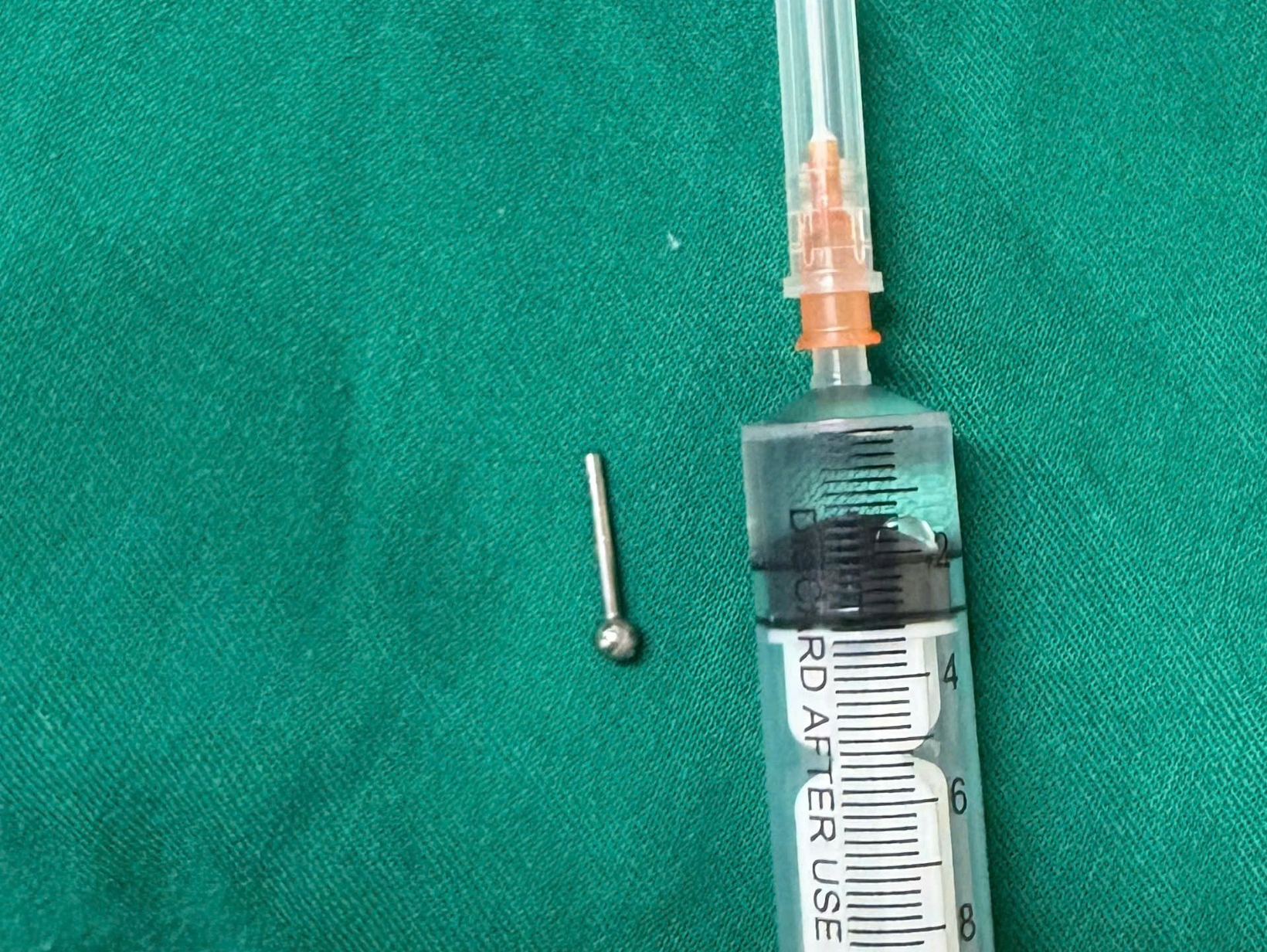 C&ocirc; g&aacute;i 19 tuổi bị khuy&ecirc;n đeo ở lưỡi rơi v&agrave;o dạ d&agrave;y trong l&uacute;c ăn- Ảnh 1.
