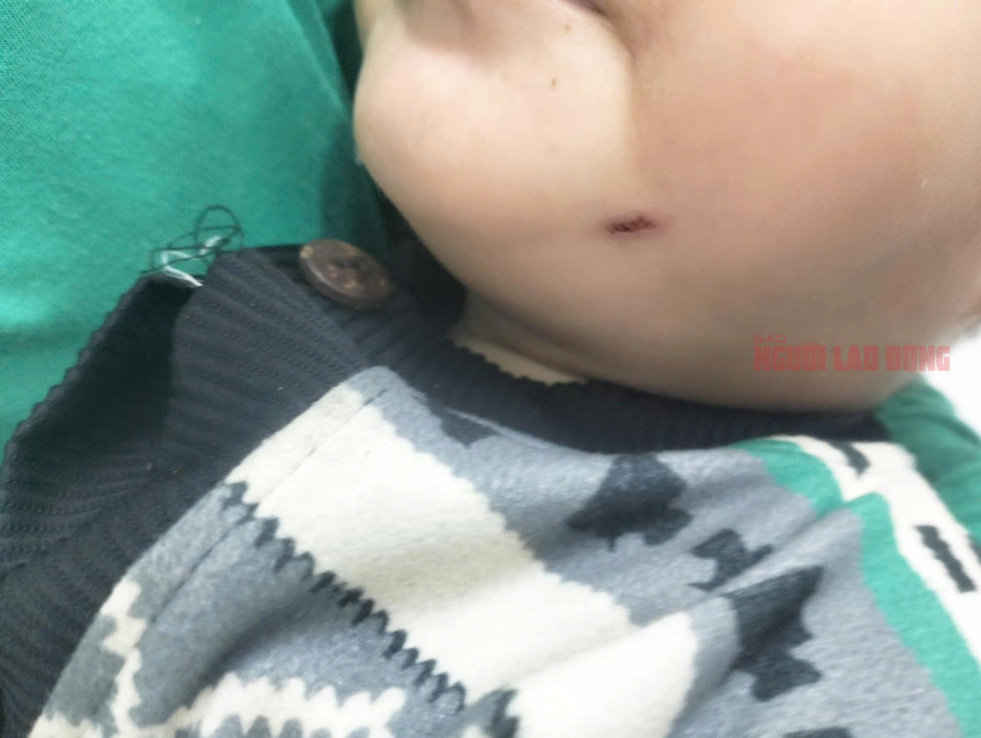 Bảo mẫu đ&aacute;nh trẻ d&atilde; man ở Quảng Nam: Qu&ecirc;n tắt camera phụ huynh mới ph&aacute;t hiện- Ảnh 4.