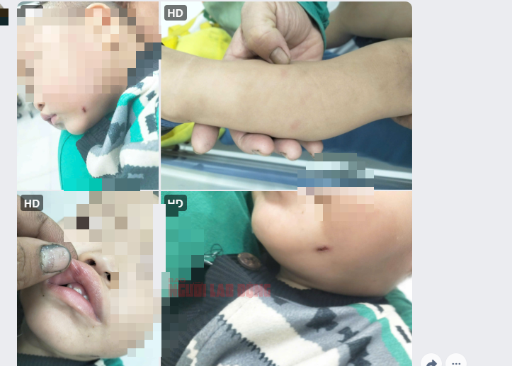 Bảo mẫu hành hạ trẻ ở Quảng Nam: Phẫn nộ tột độ, không thể để tái diễn!- Ảnh 2.