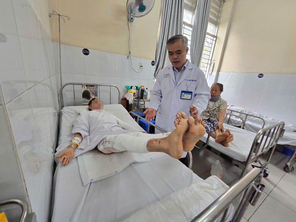 Một bệnh nhân bị phỏng cồn y tế đang điều trị tại Bệnh viện Chợ Rẫy