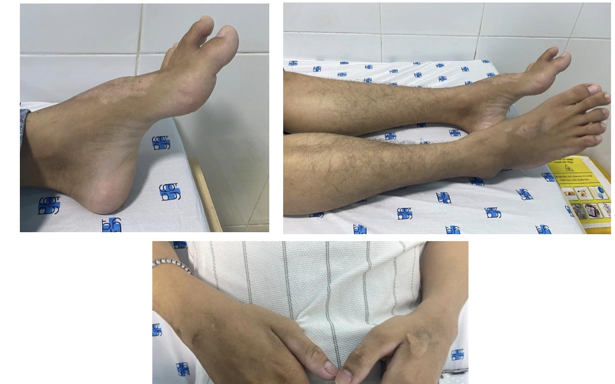 Mắc bệnh lạ, nhiều năm mới phát hiện