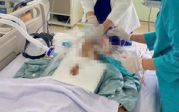 Đang ăn cỗ, cụ ông phải đi cấp cứu