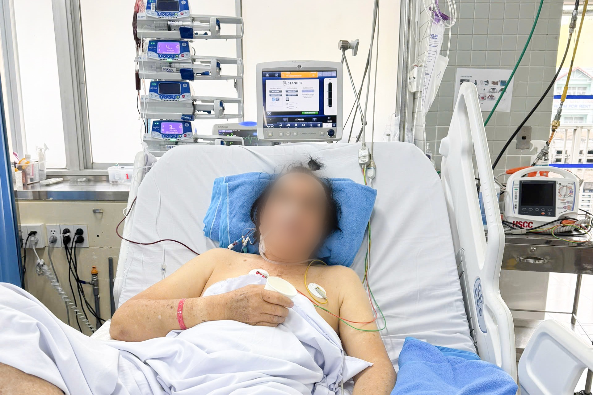 Bệnh viện Chợ Rẫy th&ocirc;ng tin th&ecirc;m về ca cứu sống nghệ sĩ Thanh Tuấn ngưng tim- Ảnh 1.