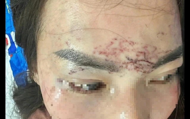 Khởi tố vụ bắt người phụ nữ đem về xăm, cắt tóc và đánh đập gây chấn động dư luận ở Cà Mau