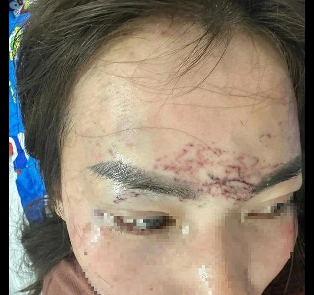 Khởi tố vụ bắt người phụ nữ đem về xăm, cắt tóc và đánh đập gây chấn động dư luận ở Cà Mau- Ảnh 1.