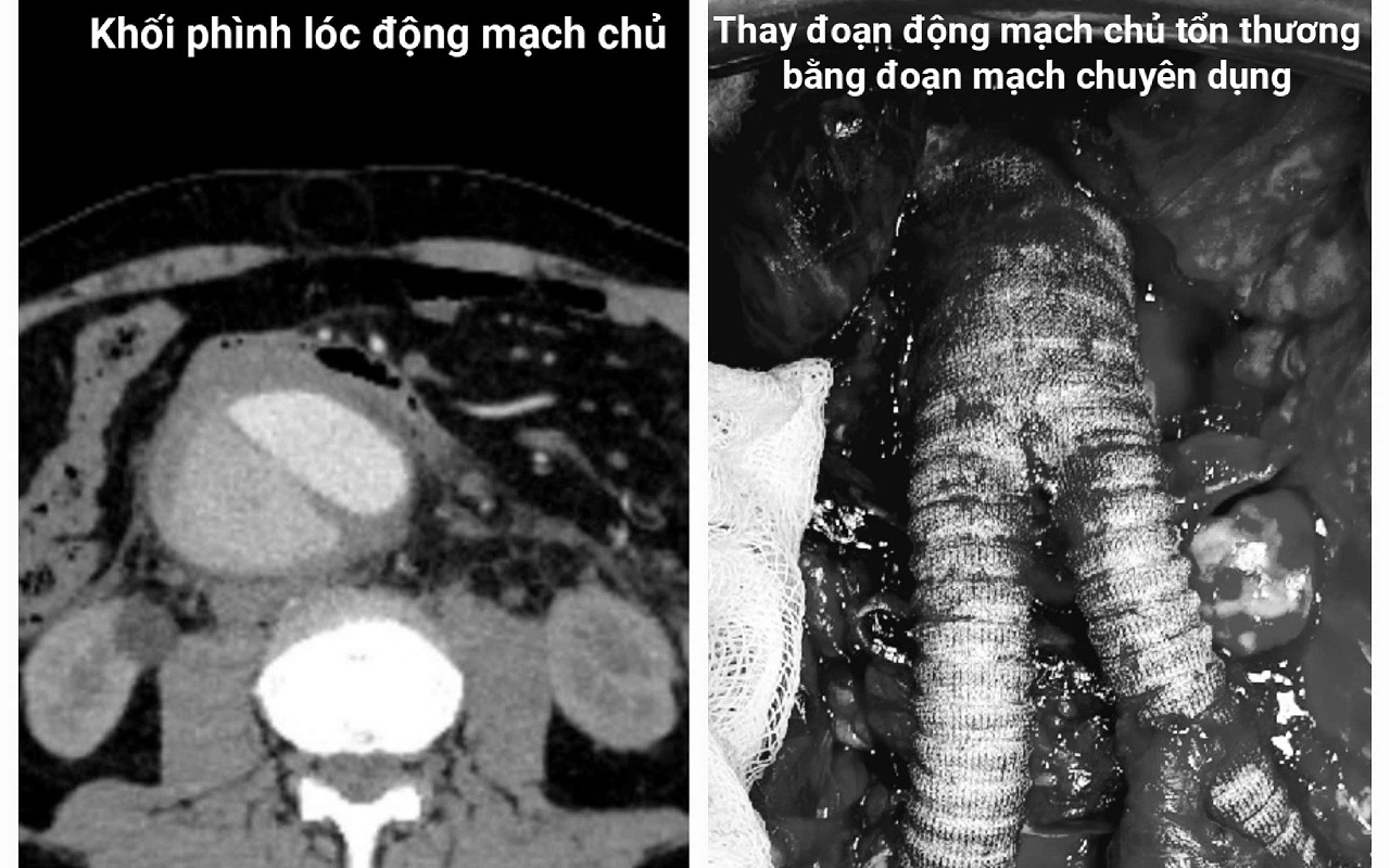Du khách nước ngoài nguy kịch, bác sĩ Việt cứu sống ngoạn mục