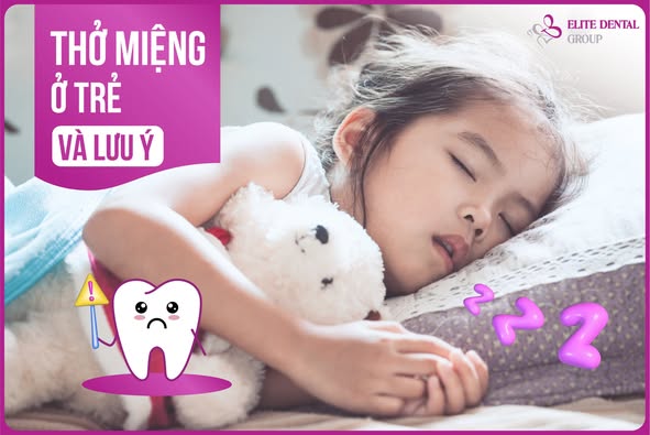 Trẻ thở bằng miệng khi ngủ? Đừng bỏ qua dấu hiệu khiến xương h&agrave;m ph&aacute;t triển lệch lạc- Ảnh 3.