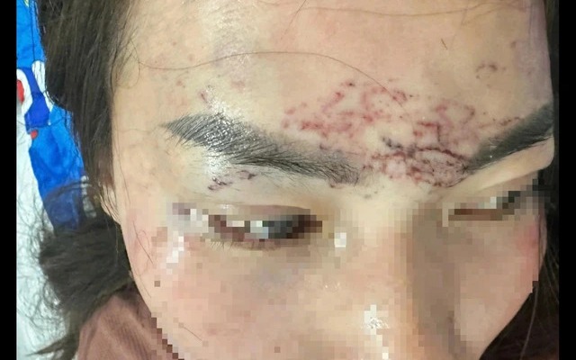 Diễn biến nóng vụ người phụ nữ ở Cà Mau bị cắt tóc, xăm mặt