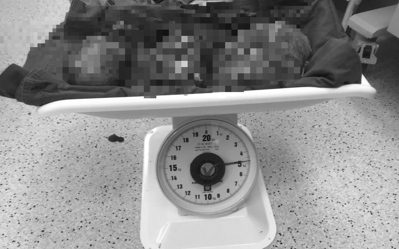 Bệnh viện Vũng Tàu tách khối u nặng 5 kg khỏi bụng người phụ nữ 56 tuổi