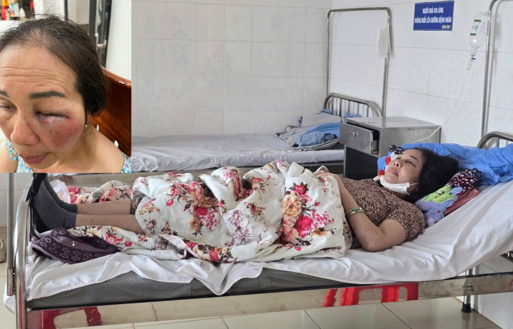 Làm rõ việc tiểu thương tố bị hành hung- Ảnh 1.
