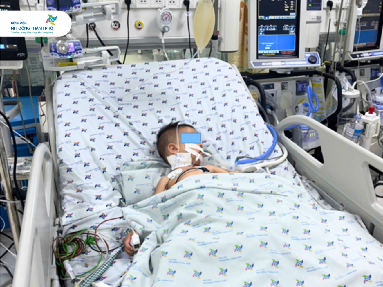 Bé trai 2 tuổi nguy kịch vì bệnh tay chân miệng sau 2 ngày phát bệnh - Ảnh 1.
