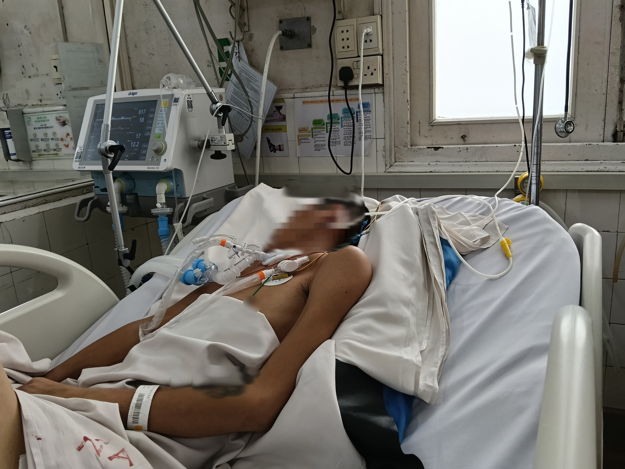Muỗi đốt kh&ocirc;ng chỉ mắc sốt xuất huyết m&agrave; c&ograve;n c&oacute; thể g&acirc;y ra căn bệnh nguy hiểm n&agrave;y - Ảnh 1.