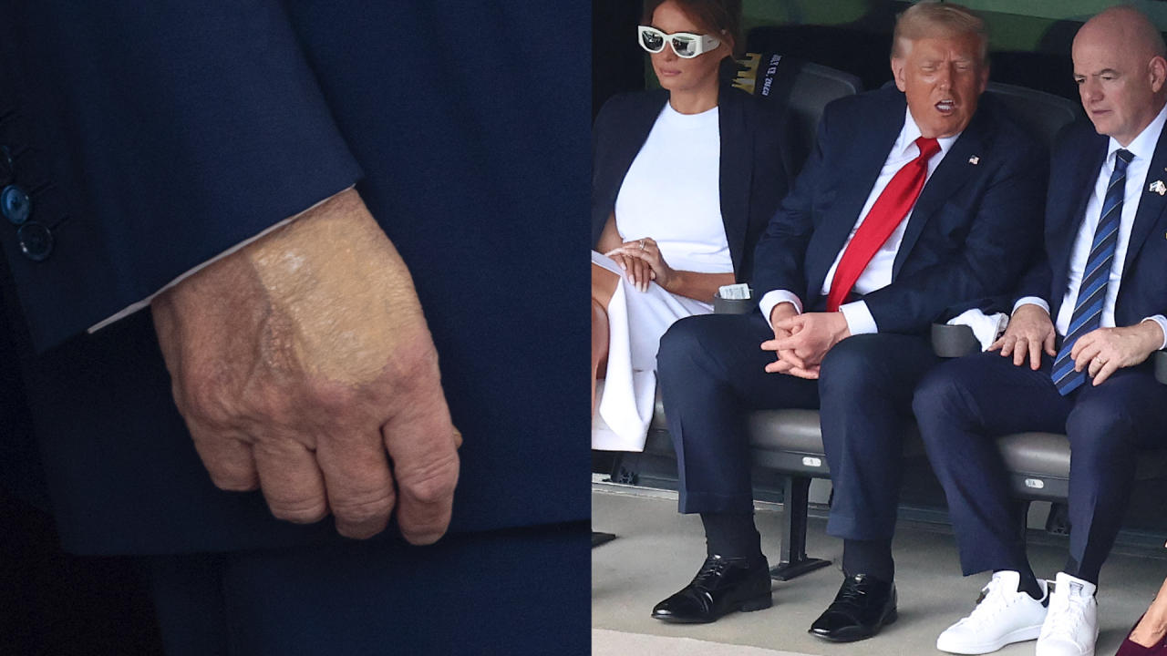 Nh&agrave; Trắng th&ocirc;ng b&aacute;o Tổng thống Donald Trump mắc suy tĩnh mạch mạn t&iacute;nh- Ảnh 1.