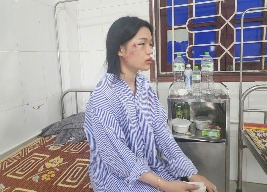 Nạn nh&acirc;n vụ xe kh&aacute;ch lật ở H&agrave; Tĩnh: &ldquo;Khung cảnh l&uacute;c đ&oacute; rất hỗn loạn v&agrave; kinh ho&agrave;ng&rdquo;- Ảnh 1.